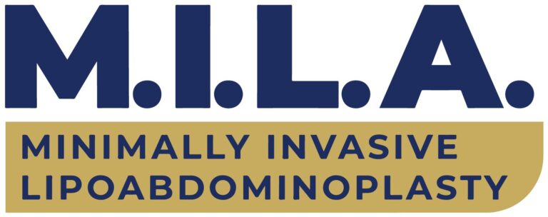 mila - abdominoplastia sem cortes